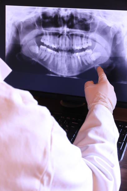 Best Emergency Treatment for Dental Infections or Abscesses in Chapin, SC