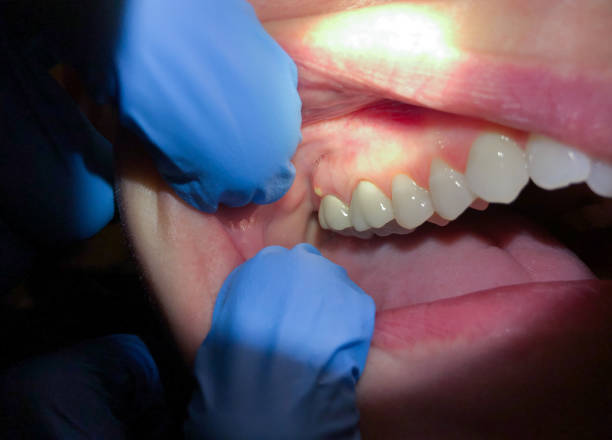Best Cosmetic Emergency Dentistry in Chapin, SC