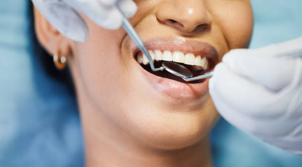 Best Emergency Treatment for Dental Infections or Abscesses in Chapin, SC